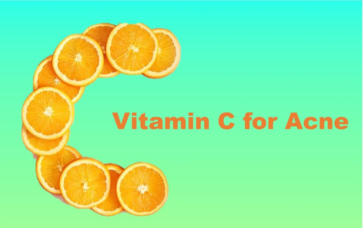 Does Vitamin C Help Acne and other skin Problems