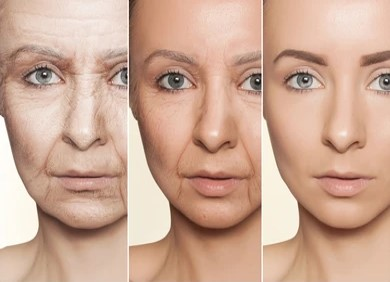 3-cinnamon tea benefits-Fight Skin Aging